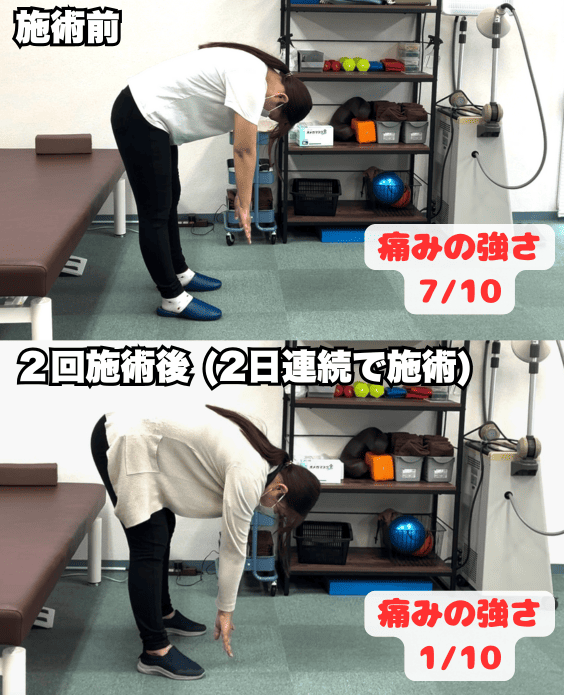 ぎっくり腰の女性