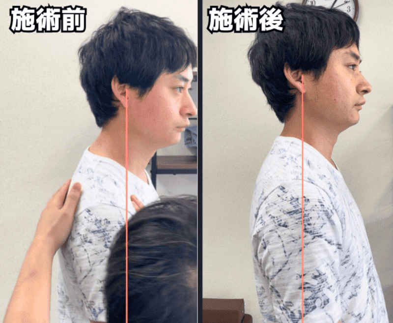 姿勢改善の写真